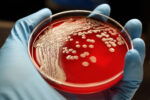 Human hand holding MRSA colonies on blood agar plate.